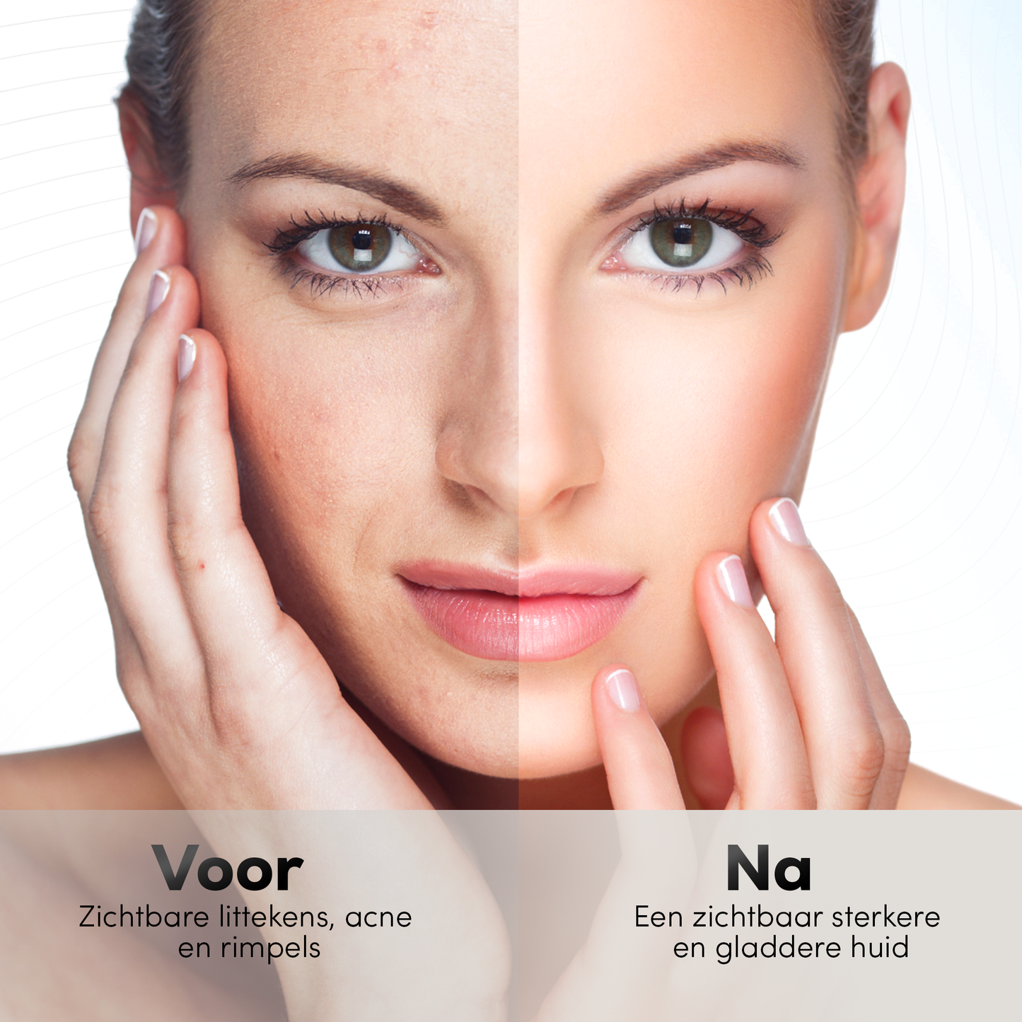 La-Nou White Dermastamp